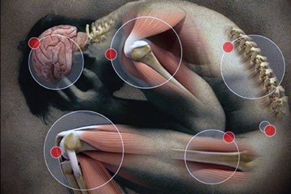 Financial stress may cause more physical pain