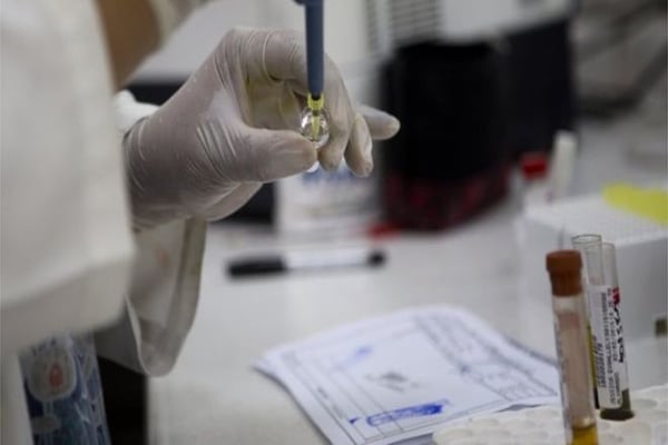 Panama reports Zika baby brain case