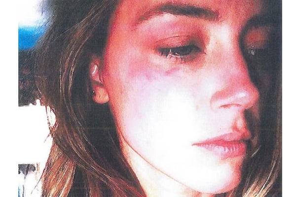 Amber Heard accuses Johnny Depp of domestic violence