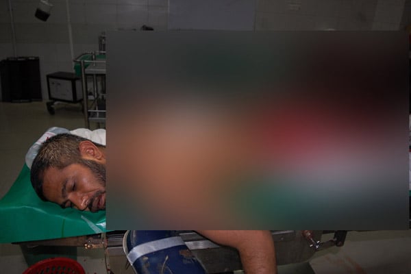 3 supporters of independent candidate hurt in attack in Bogra