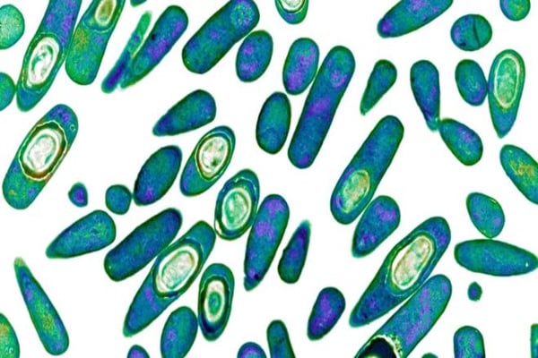 Superbugs will 'kill every three seconds'