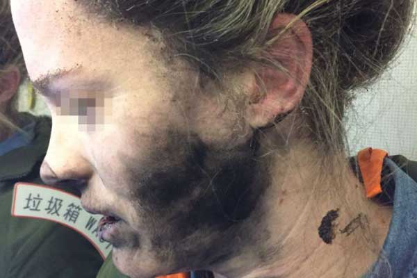 Headphone batteries explode on flight to Australia