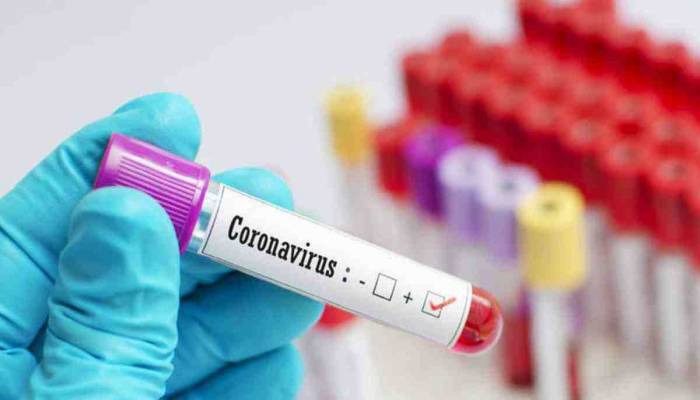 Physician dies of Covid-19 in Moulvibazar