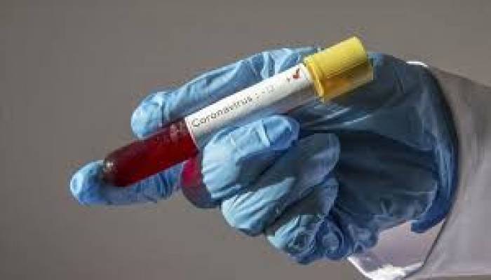 21 more Covid 19 deaths, 1,508 new infections