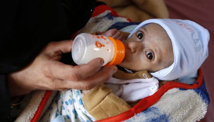 Over 10m children to undergo acute malnutrition in 2021, says UNICEF