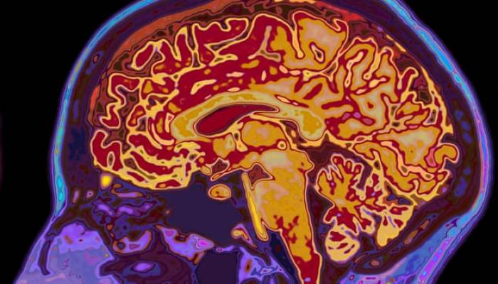 Covid linked to risk of mental illness and brain disorder, study suggests