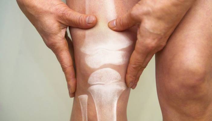 Exercise is good for joints with wear-and-tear arthritis