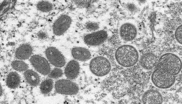 WHO says monkeypox is not yet a health emergency