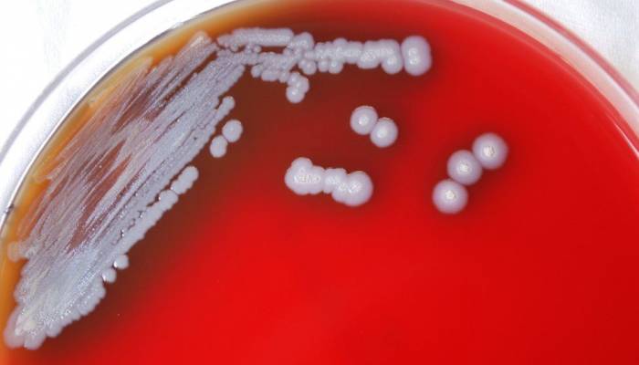 Dangerous bacterium found