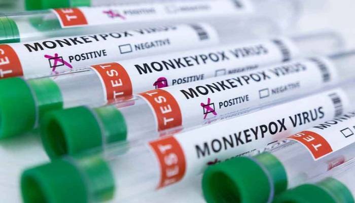 India reports first case of monkeypox