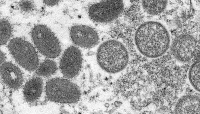 EU approves monkeypox vaccine