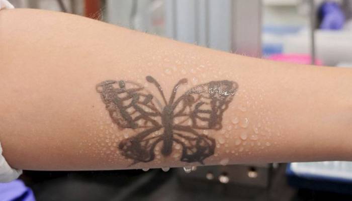 Nanotech tattoo to monitor health of South Koreans