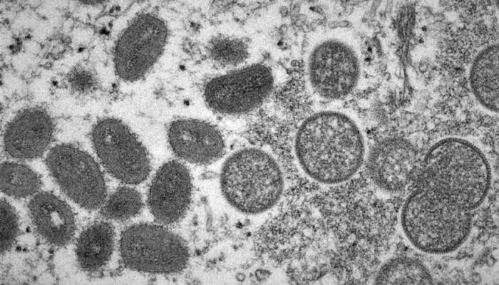 Kerala reports India’s first monkeypox-related death