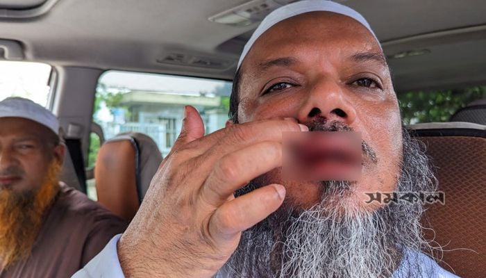 BCC polls: Islami Andolan candidate Faizul allegedly attacked