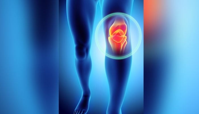 One billion people globally to have Osteoarthritis by 2050: Study