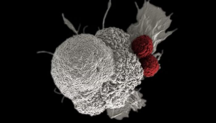 Prostate cancer cases to double over two decades: study