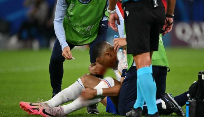 Mbappe breaks nose in France Euro 2024 win