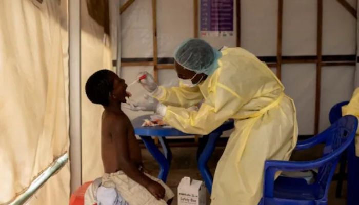 Mpox is not the new Covid, says WHO