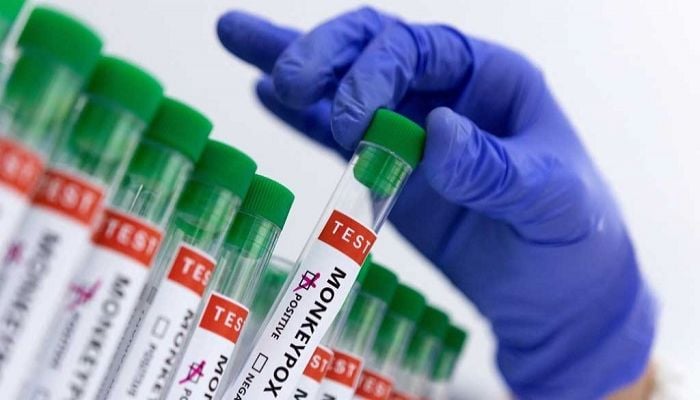 EU public health body raises monkeypox risk alert level