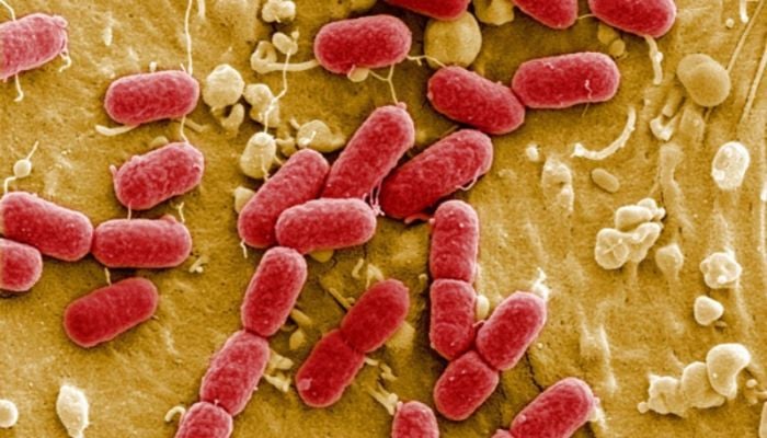 Drug-resistant superbugs projected to kill 39 million by 2050