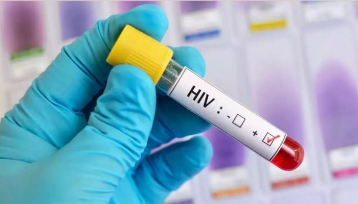 HIV cases and deaths declining globally