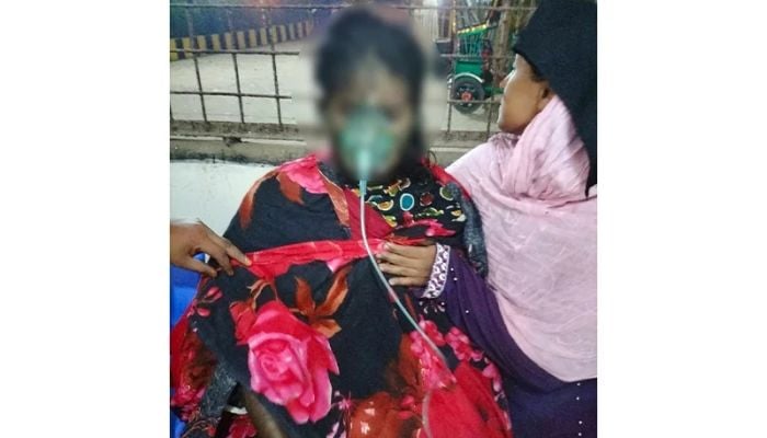 Woman dies after being burned by husband in Chattogram