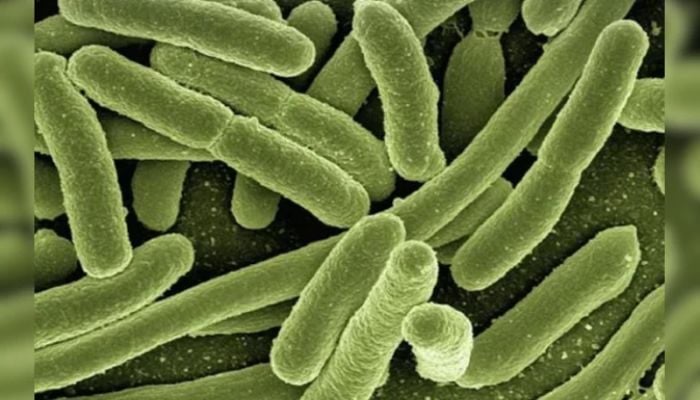 'Bleeding eye' virus kills 15 in Rwanda