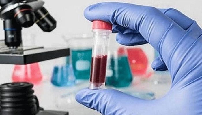 Dope testing initiated in prisons, 8 individuals identified