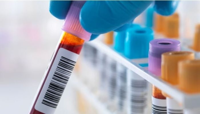 Scientists develop first ‘accurate blood test’ to detect chronic fatigue syndrome