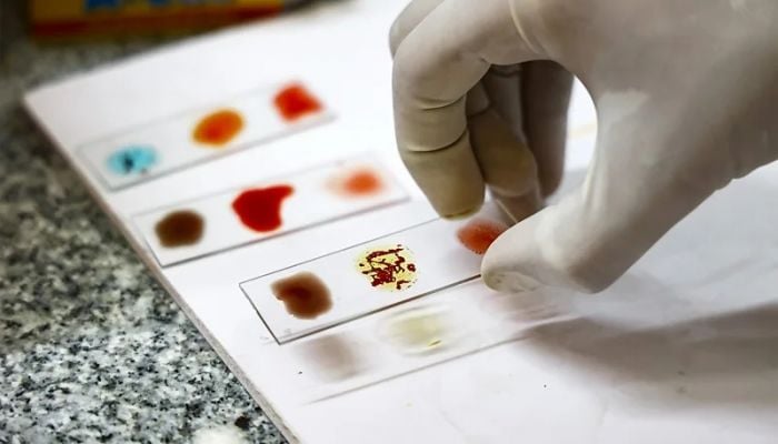 The magic of the world's rarest blood type