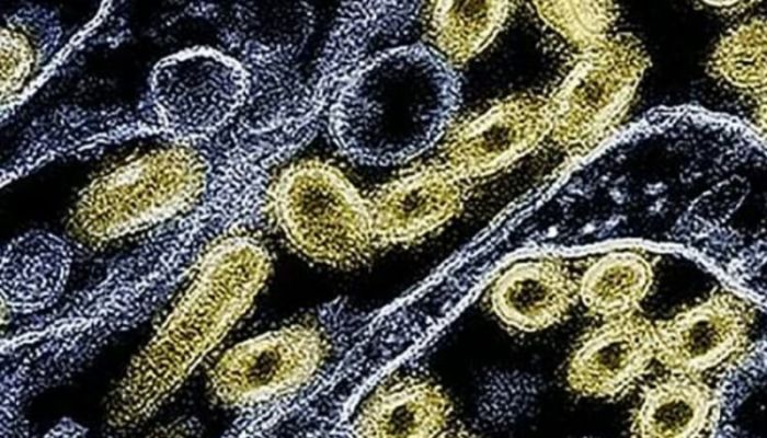 US records second human bird flu death of year
