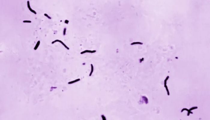 Tuberculosis kills 1.23 million last year: WHO