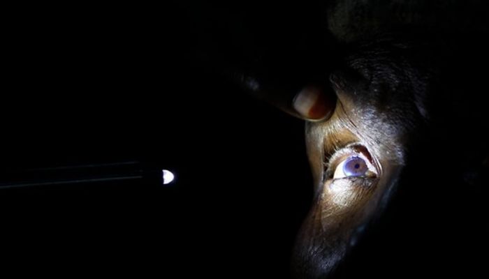 94 million need cataract surgery, but access lacking: WHO