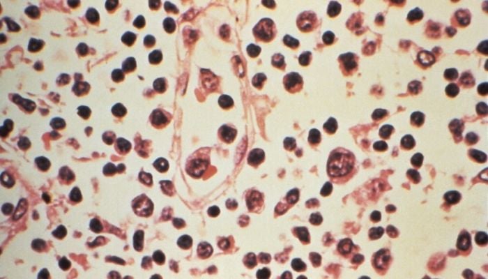 WHO chief tells AFP hantavirus outbreak not like start of Covid pandemic